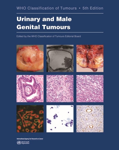 Urinary and Male Genital Tumours cover