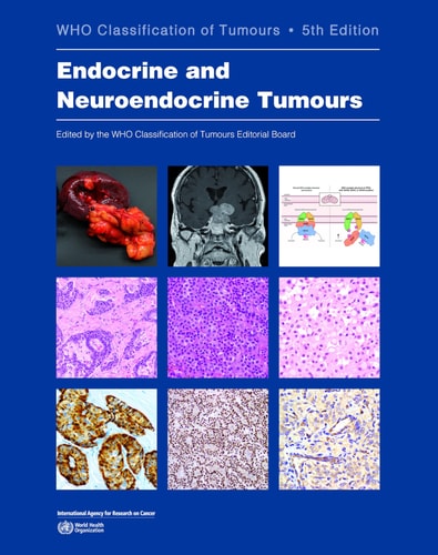 Endocrine and Neuroendocrine Tumours cover
