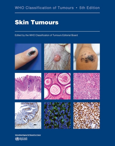 Skin Tumours Who Classification of Tumours cover