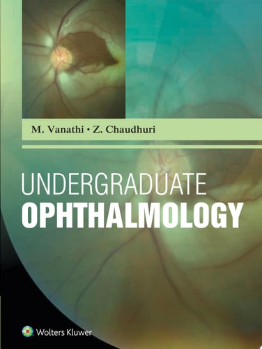 Undergraduate Ophthalmology cover
