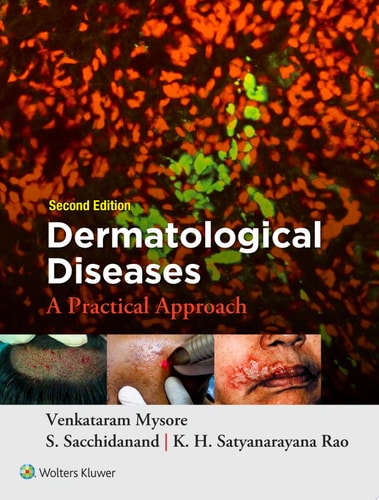 Dermatological Diseases: A Practical Approach cover