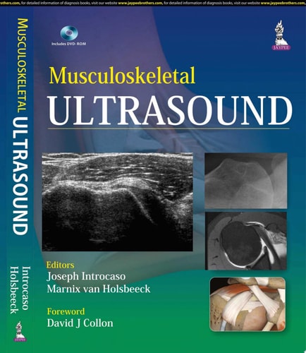 Musculoskeletal Ultrasound cover