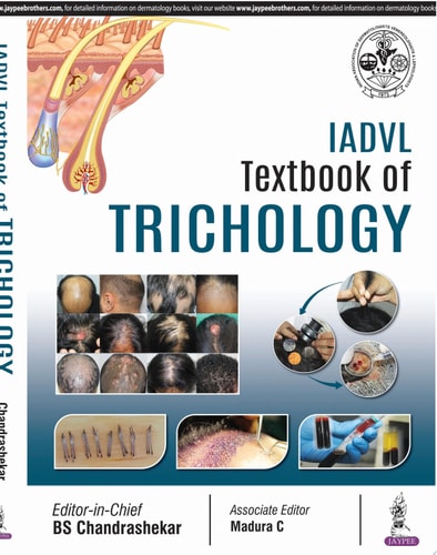 IADVL Textbook of Trichology cover