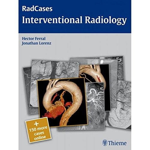 Radcases: Interventional Radiology (Ie) cover