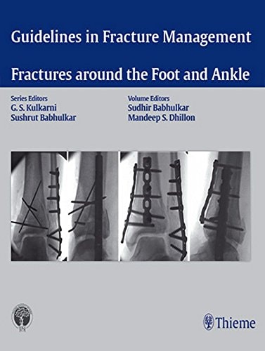 Fracture Around the Foot and Ankle cover