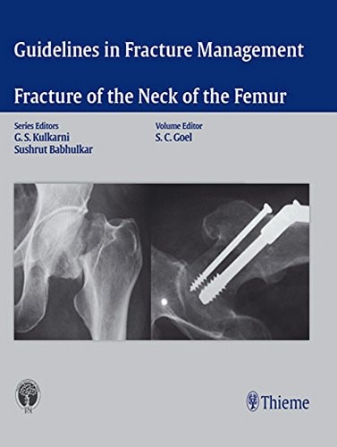 Fracture of the neck of the Femur cover