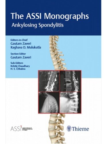 Association of Spine Surgeons of India (ASSI) Monograph Series: Ankylosing Spondylitis cover