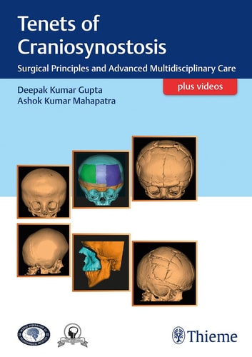 Tenets of Craniosynostosis Surgical Principles and Advanced Multidisciplinary Care cover