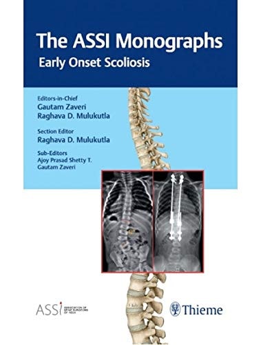 The ASSI Monographsâ€”Early Onset Scoliosis cover