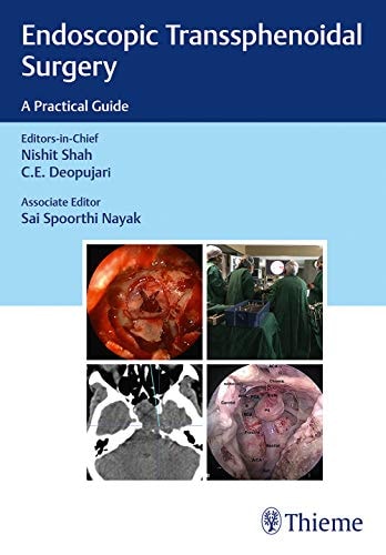 Endoscopic Transsphenoidal Surgery A Practical Guide cover