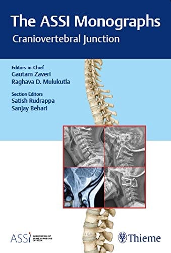 The ASSI Monographs—Craniovertebral Junction cover