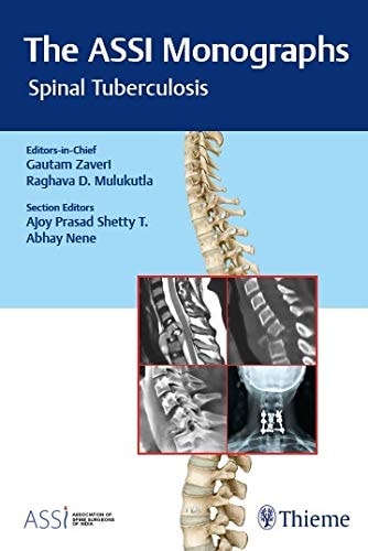 The ASSI Monographs—Spinal Tuberculosis cover