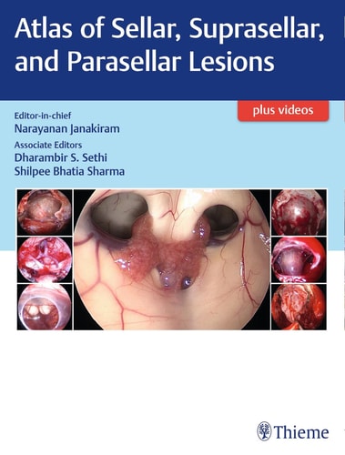 Atlas of Sellar, Suprasellar, and Parasellar Lesions cover