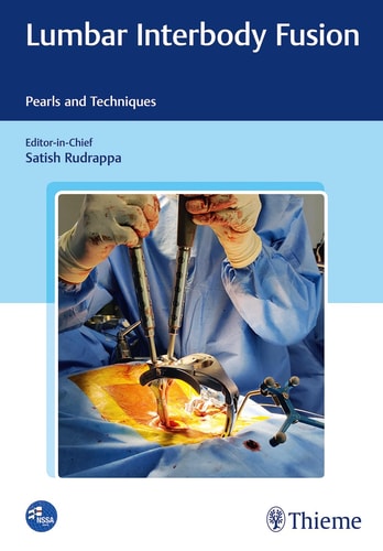 Lumbar Interbody Fusion Pearls and Techniques cover