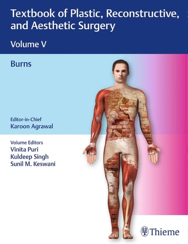 Textbook of Plastic, Reconstructive, and Aesthetic Surgery, Vol 5 Burns cover