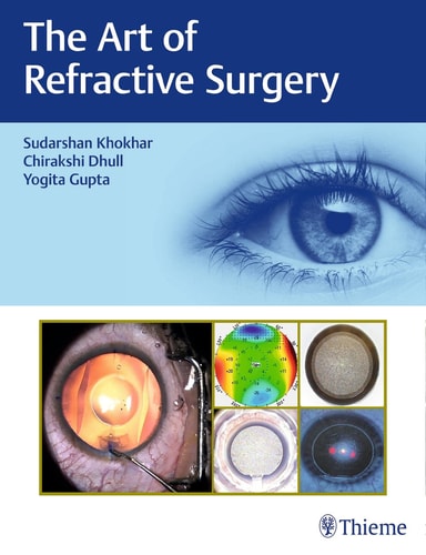 The Art of Refractive Surgery cover