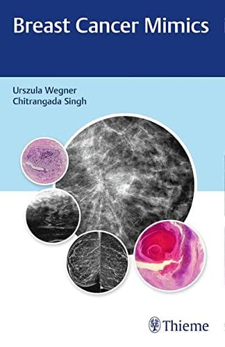 Breast Cancer Mimics cover