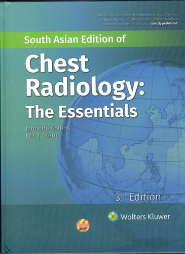 Chest Radiology : The Essentials cover