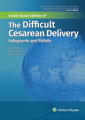 THE DIFFICULT CESAREAN DELIVERY SAFE GUARD AND PITFALLS cover