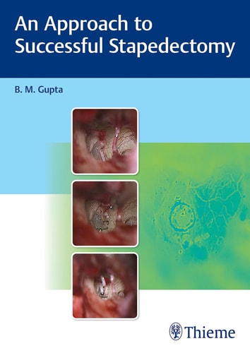 An Approach to Successful Stapedectomy cover