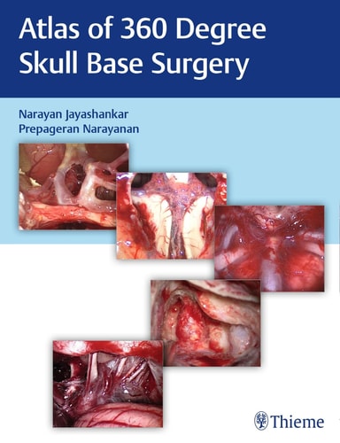Atlas of 360 Degree Skull Base Surgery cover