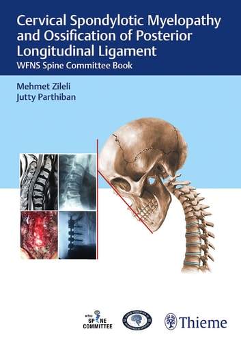 Cervical Spondylotic Myelopathy and Ossification of Posterior Longitudinal Ligament WFNS Spine Committee Book cover