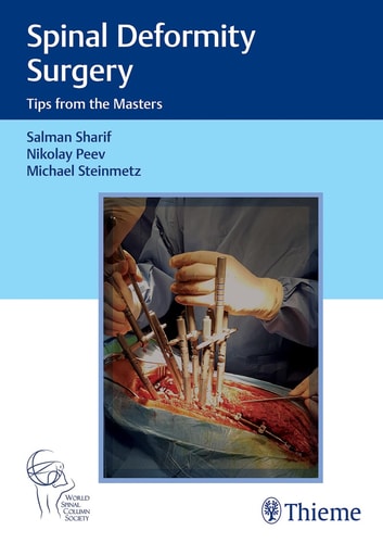 Spinal Deformity Surgery Tips from the Masters cover
