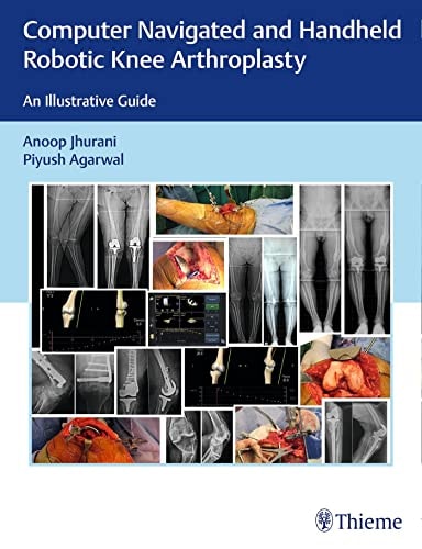 Computer Navigated and Handheld Robotic Knee Arthroplasty An Illustrative Guide cover