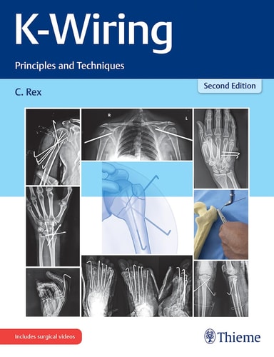 K-Wiring Principles and Techniques cover