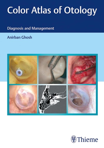 Color Atlas of Otology Diagnosis and Management cover