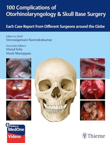 100 Complications of Otorhinolaryngology and Skull Base Surgery Each Case Report from Different Surgeons Around the Globe cover