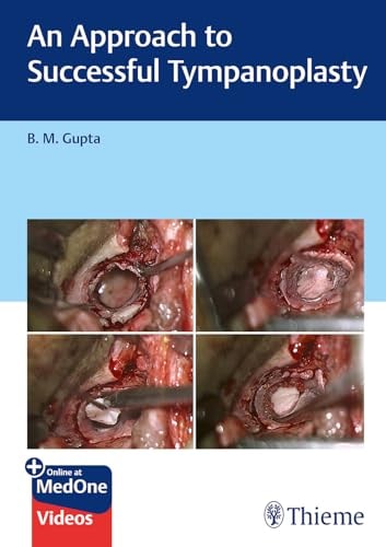 An Approach to Successful Tympanoplasty cover