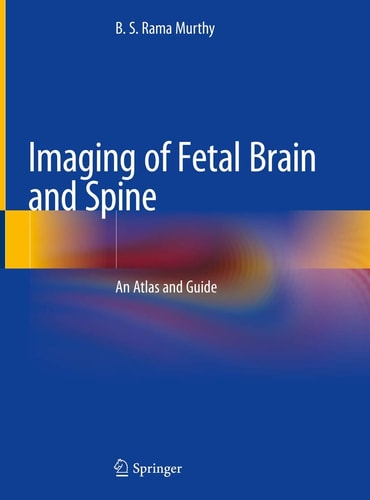 Imaging of Fetal Brain and Spine An Atlas and Guide cover
